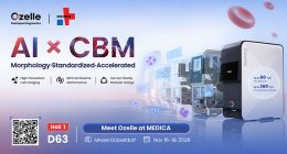 Ozelle เตรียมนำเสนอ O-Cyte 1 ในงาน MEDICA 2026 ชูระบบตรวจวิเคราะห์ทางโลหิตวิทยาที่ใช้ AI ช่วยวิเคราะห์และรองรับการขยายกำลังการตรวจ